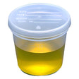 Globe Scientific 5917 Polypropylene Graduated Specimen Container with Polyethylene Separate Snap Cap, 5 oz Capacity (Case of 300)